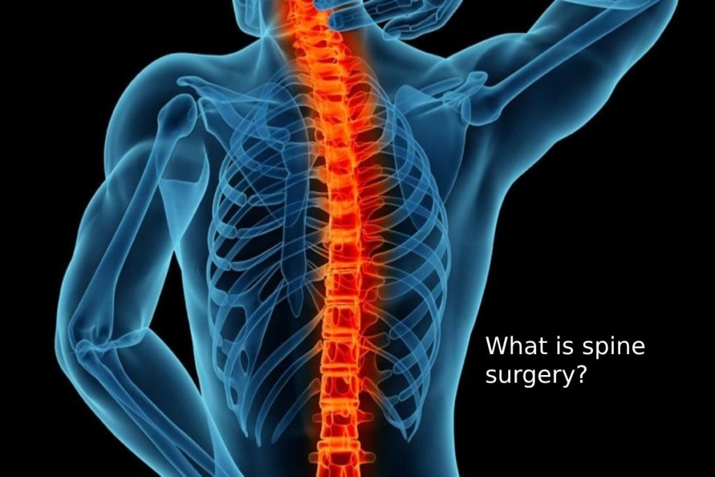 What is spine surgery