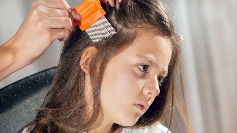 Cause of Growing Head Lice.