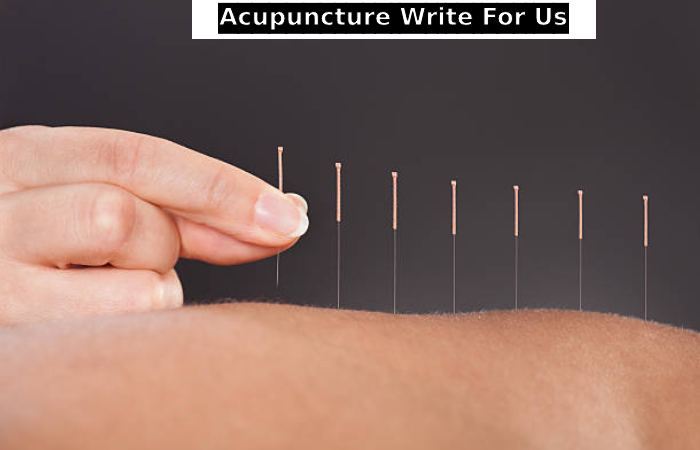 Acupuncture Write For Us