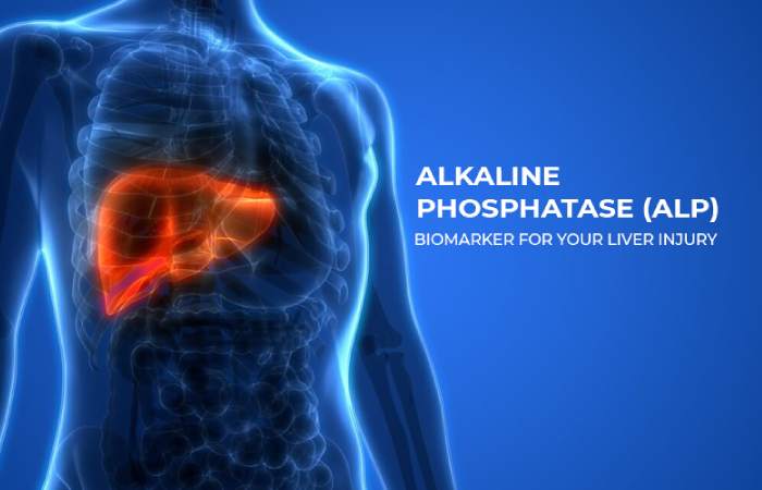 What is Alkaline Phosphatase_