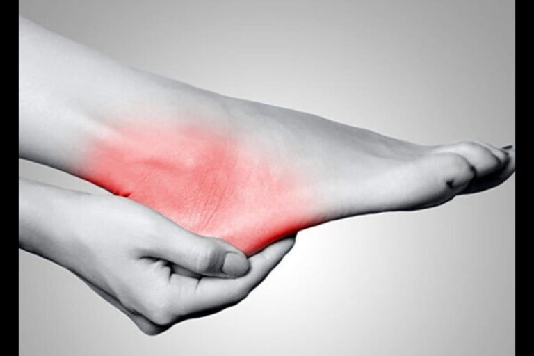 Heel Emergency: Fix It in 10 Minutes