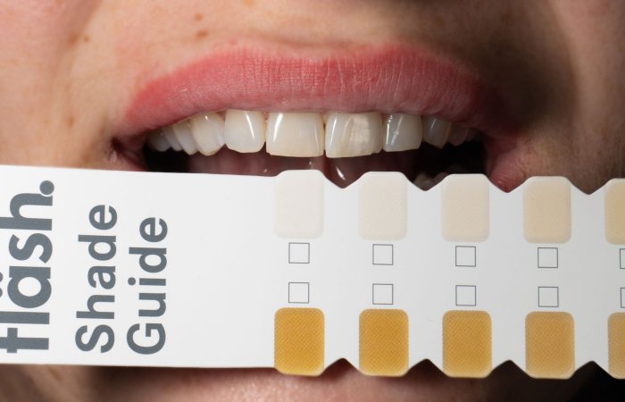 Adult holding a dental shade guide to compare tooth whitening results.